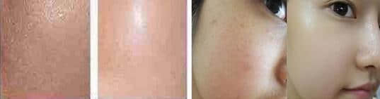 整形美容医院,哪家整形美容医院好