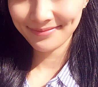 酒窝再造术,西诺整形美容，酒窝再造术后效果