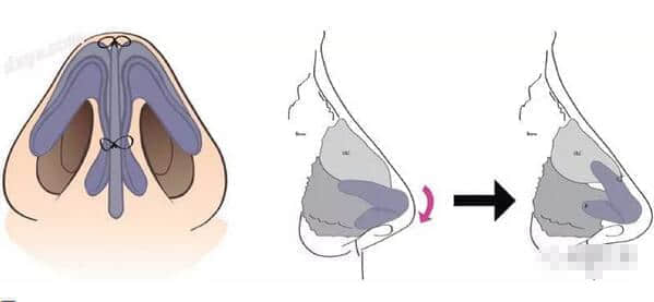 Zj6juy.jpg Zj6juy.jpg